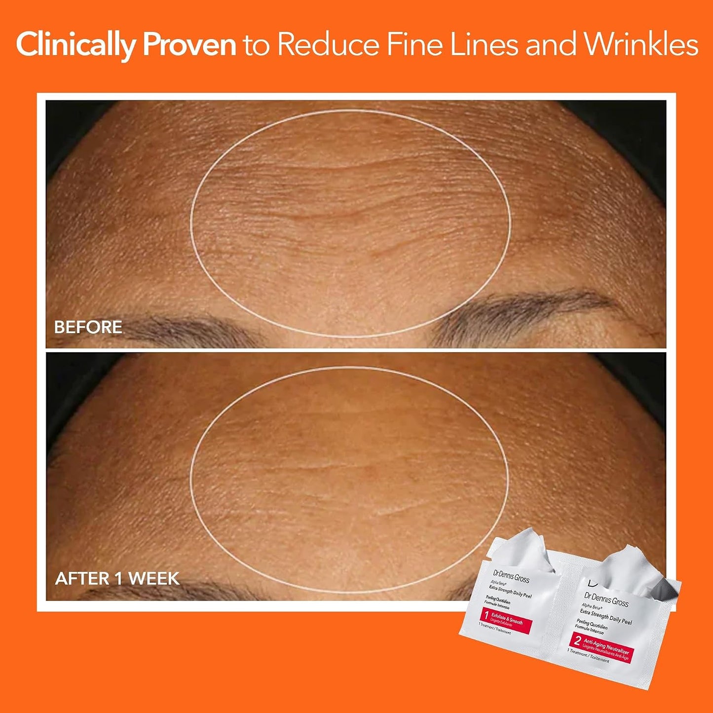 Dr. Dennis Gross Alpha Beta Daily Peel - 2-Step Exfoliating Pads for Smoother Skin & Radiance, 5 Treatments